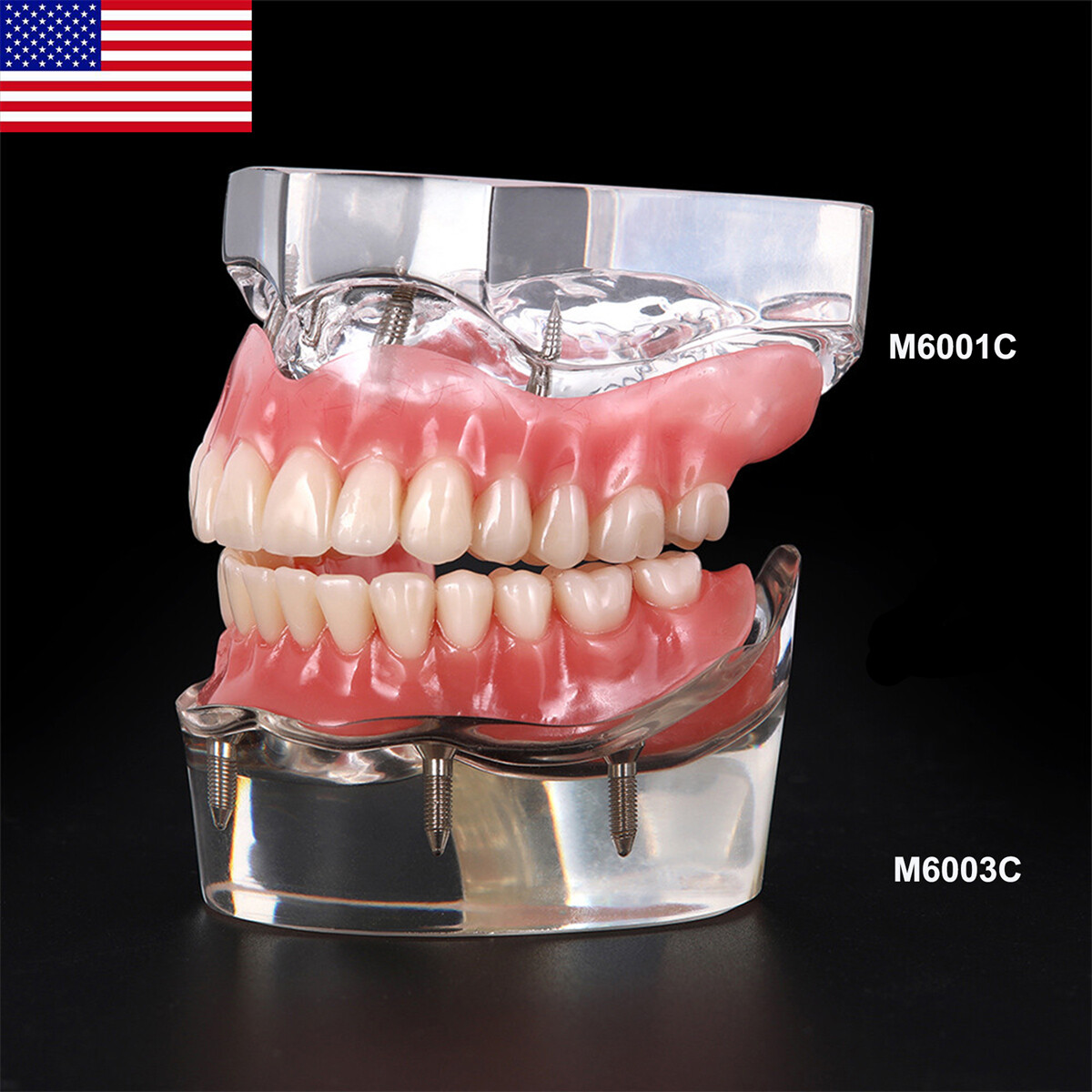 Dental Implant Teeth Demo Overdenture Restoration With 4 Implants Upper/Lower US