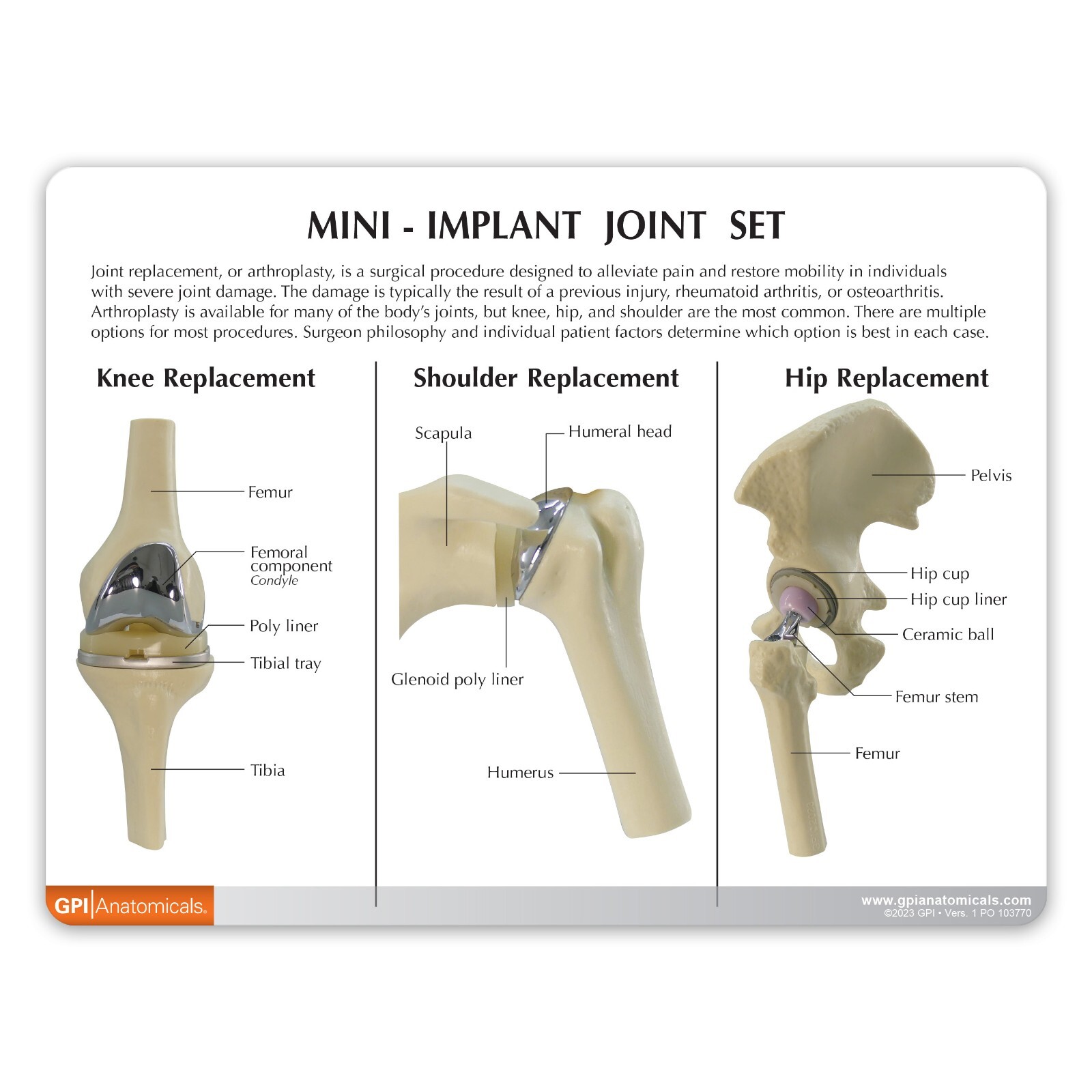 Implant Mini-Implant Joint Set of 3 GPI LFA #1910. Make Us an Offer! SEE VIDEO