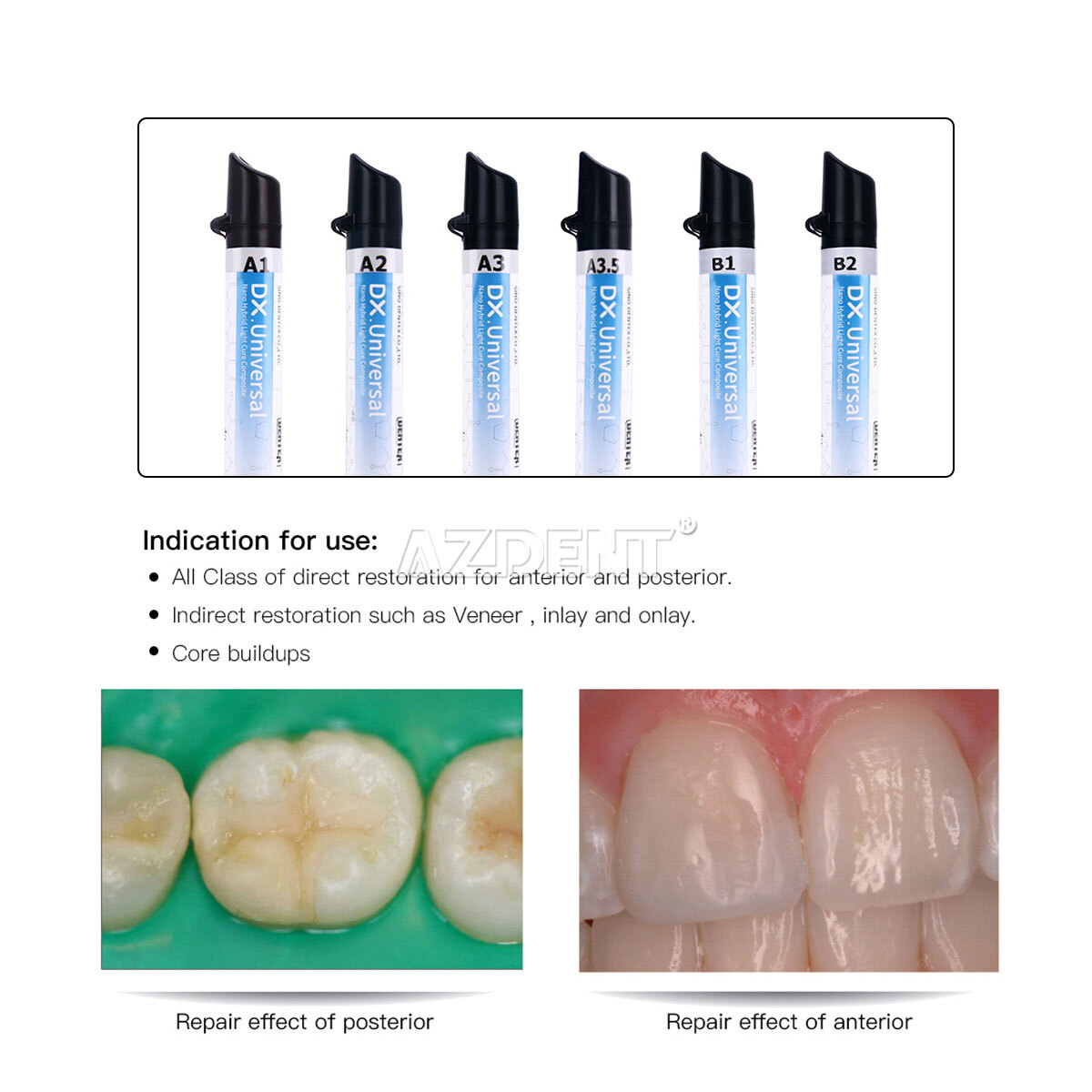 Dental Universal Light Cure Hybrid/Enamel/Flowable/Medium Flow Composite Resin