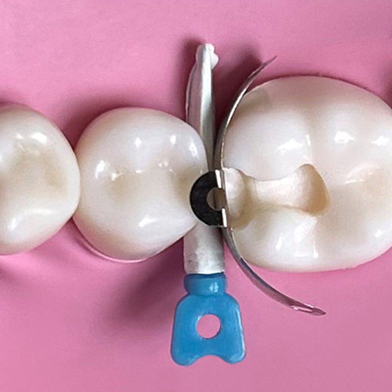 Dental Matrix Bands Ring Sectional Matrix System Clamp Plastic Tulwar Wedges