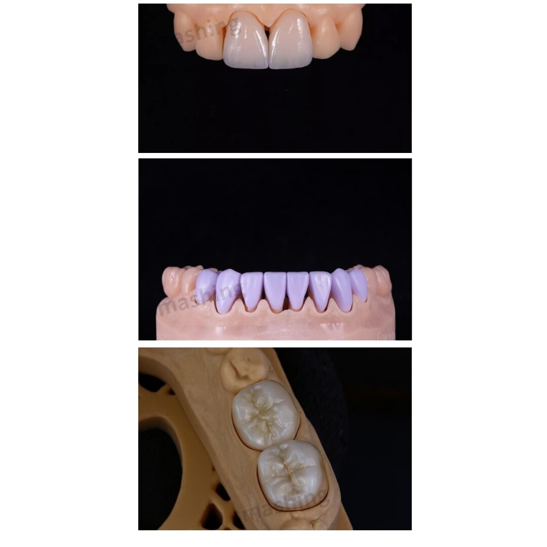 5Pcs C14 Emax Dental Glass Ceramic HT LT Lithium Dislicate CAD/CAM Cerec Blocks