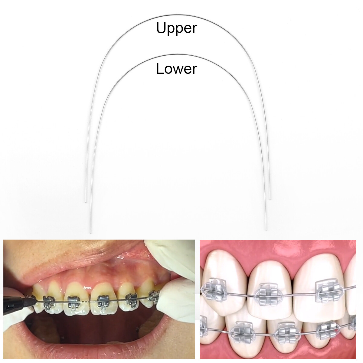 AZDENT Dental Orthodontic Round Arch Wire Super Elastic Niti Ovoid / Nature Form