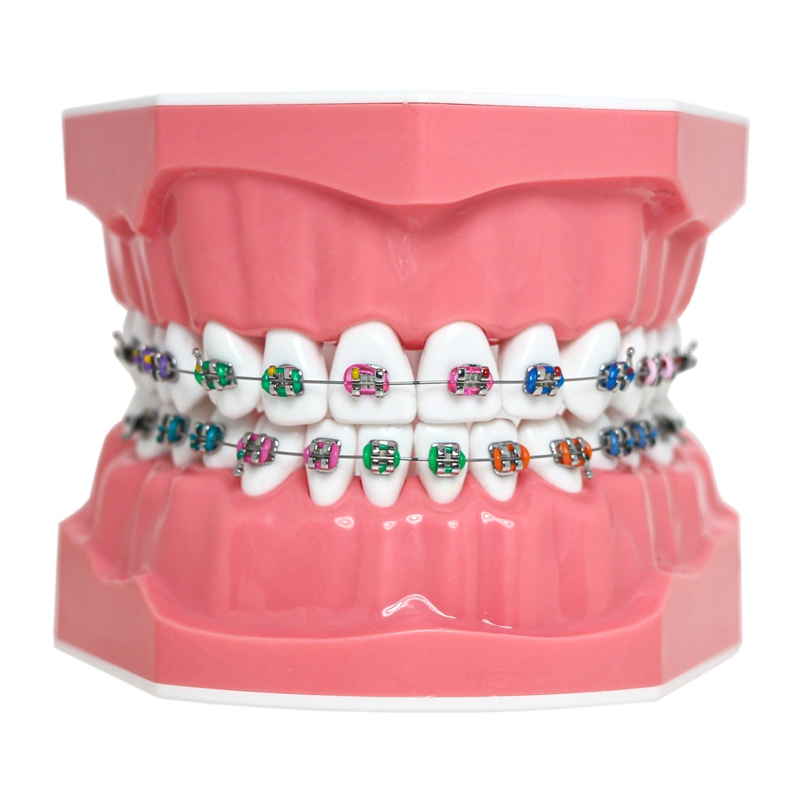 US Dental Orthodontic Typodont 1:1 Teeth Model with Brackets Braces M7010-2 New