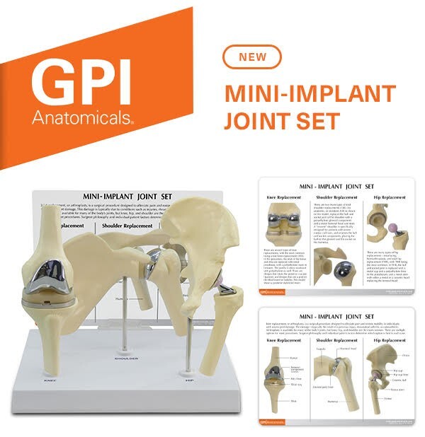 Implant Mini-Implant Joint Set of 3 GPI LFA #1910. Make Us an Offer! SEE VIDEO