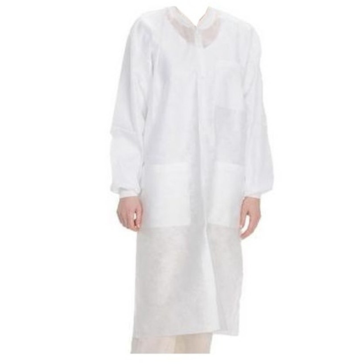 ValuMax 3560WHXS EasyBreathe Lab Coats White Extra Small 10/Pk