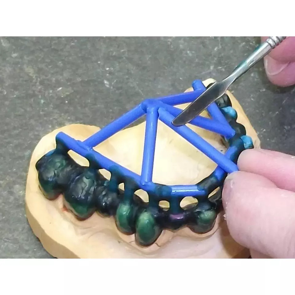 Maarc Wire Wax Designed For Creating Sprues Used Casting of Dental Prostheses.