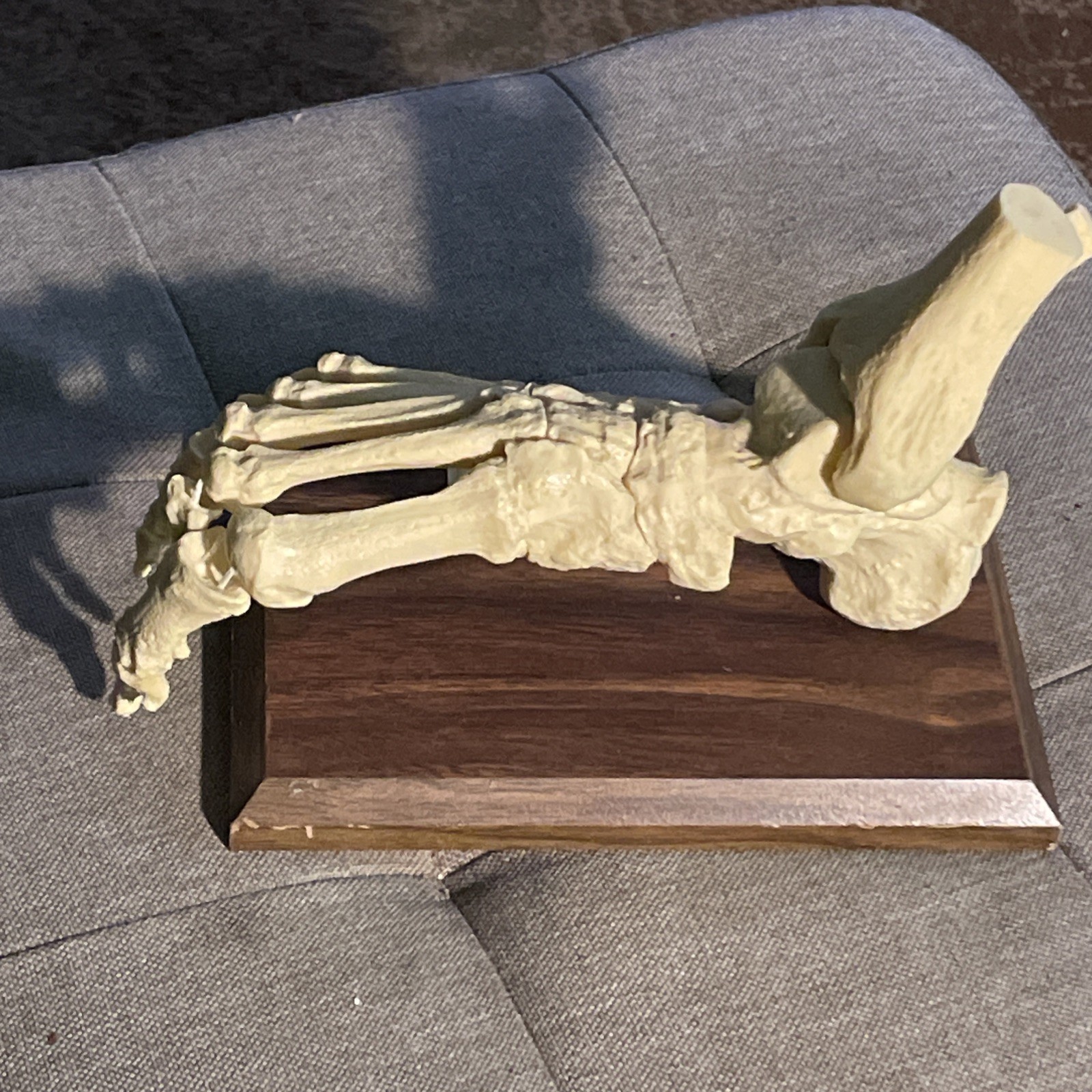 Foot BONES medical anatomical model dissection human anatomy Relafen nabumetone