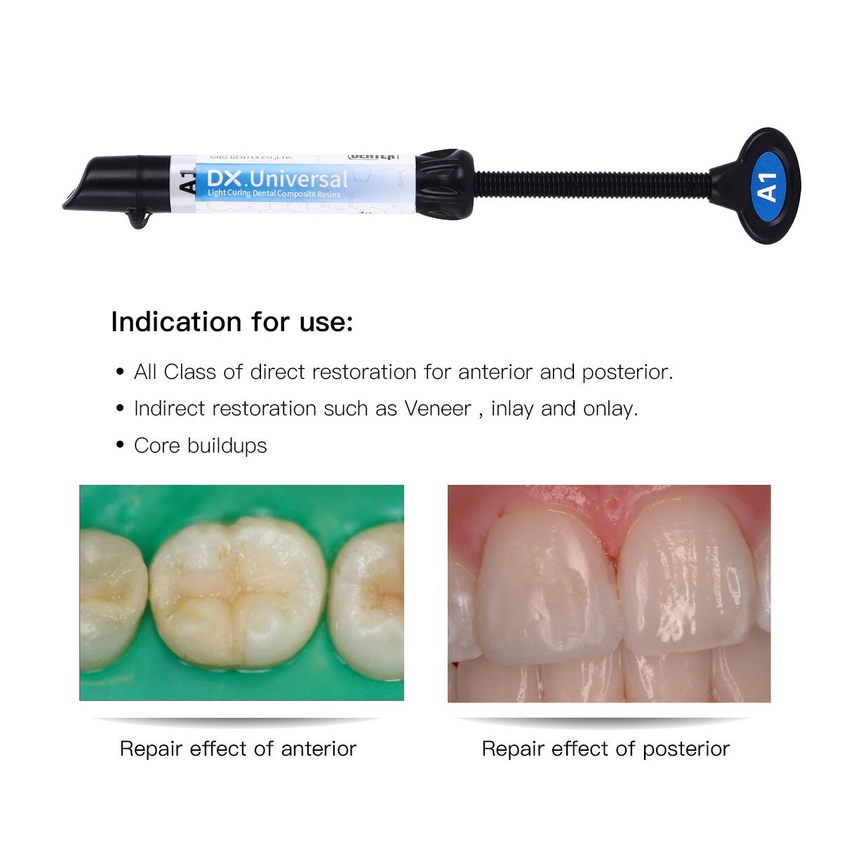 Dental Resina Fotopolimerizable Esmalte Dentinario /Adhesivo Visible /37% Ácido