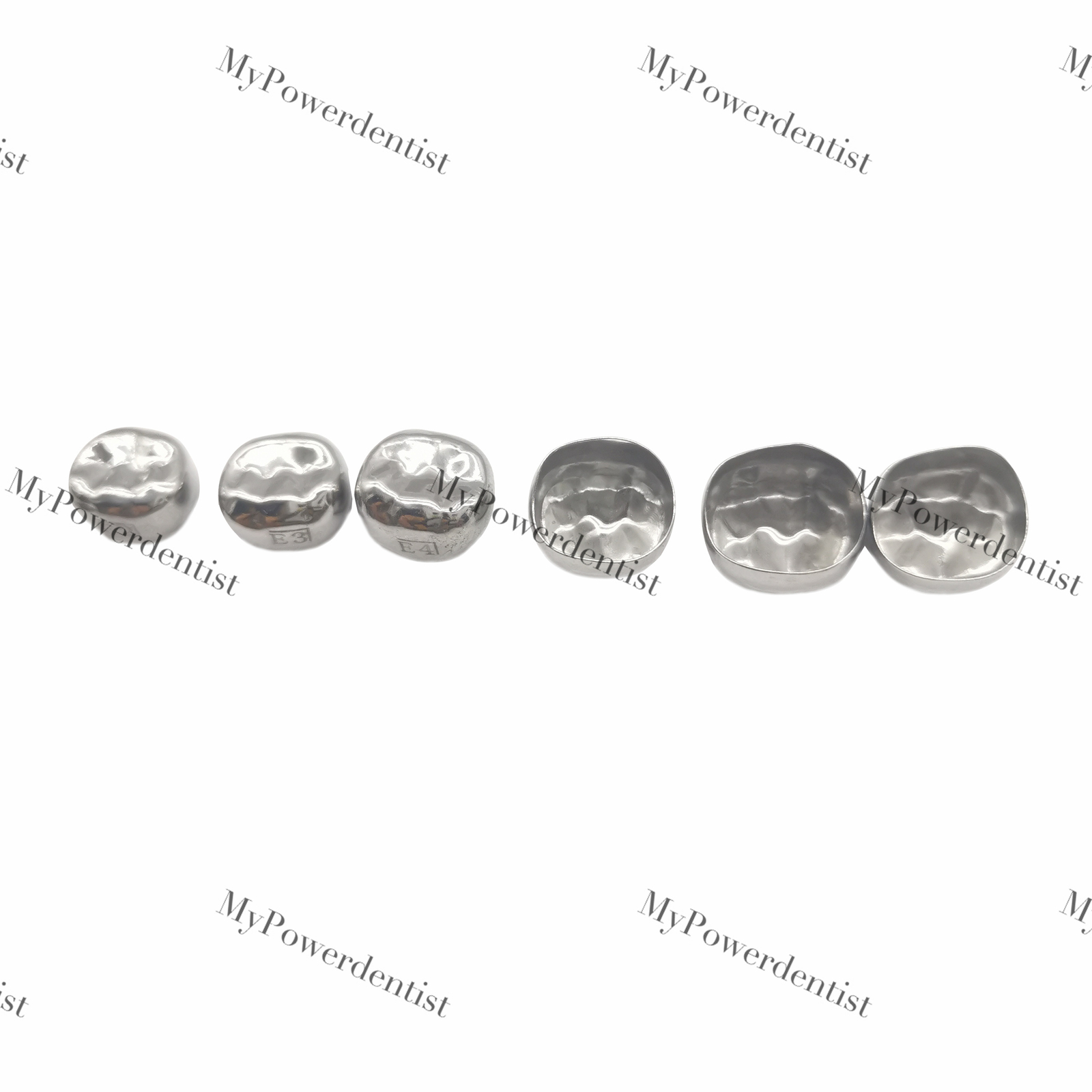 Dental Kids Primary Molar Crown Stainless Steel Kit/Refill 48Size