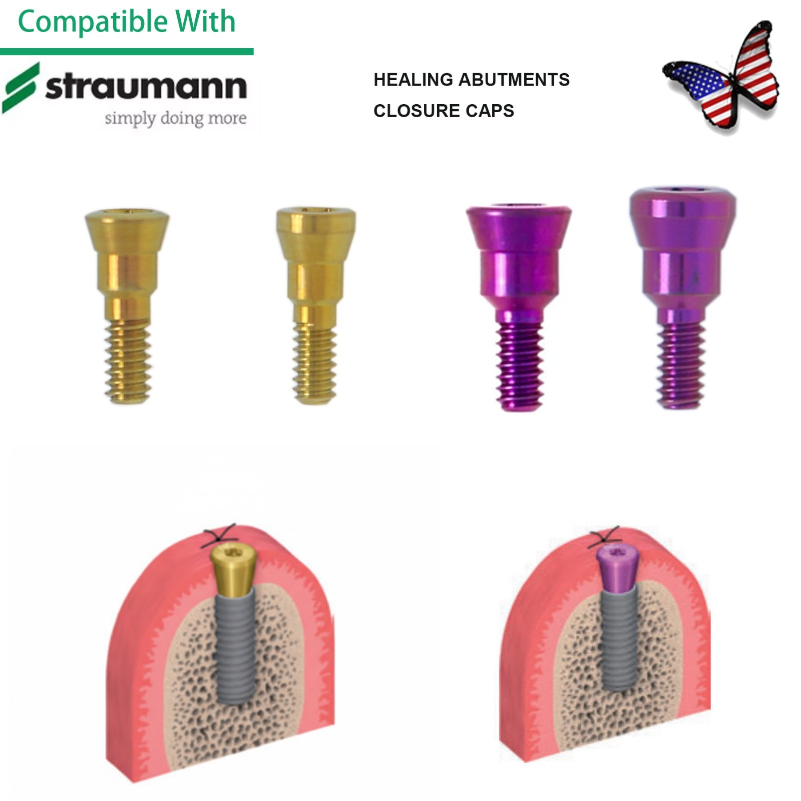 Straumann NC/RC Healing Abutment Closure Cap Scan Body Analog Impression Coping