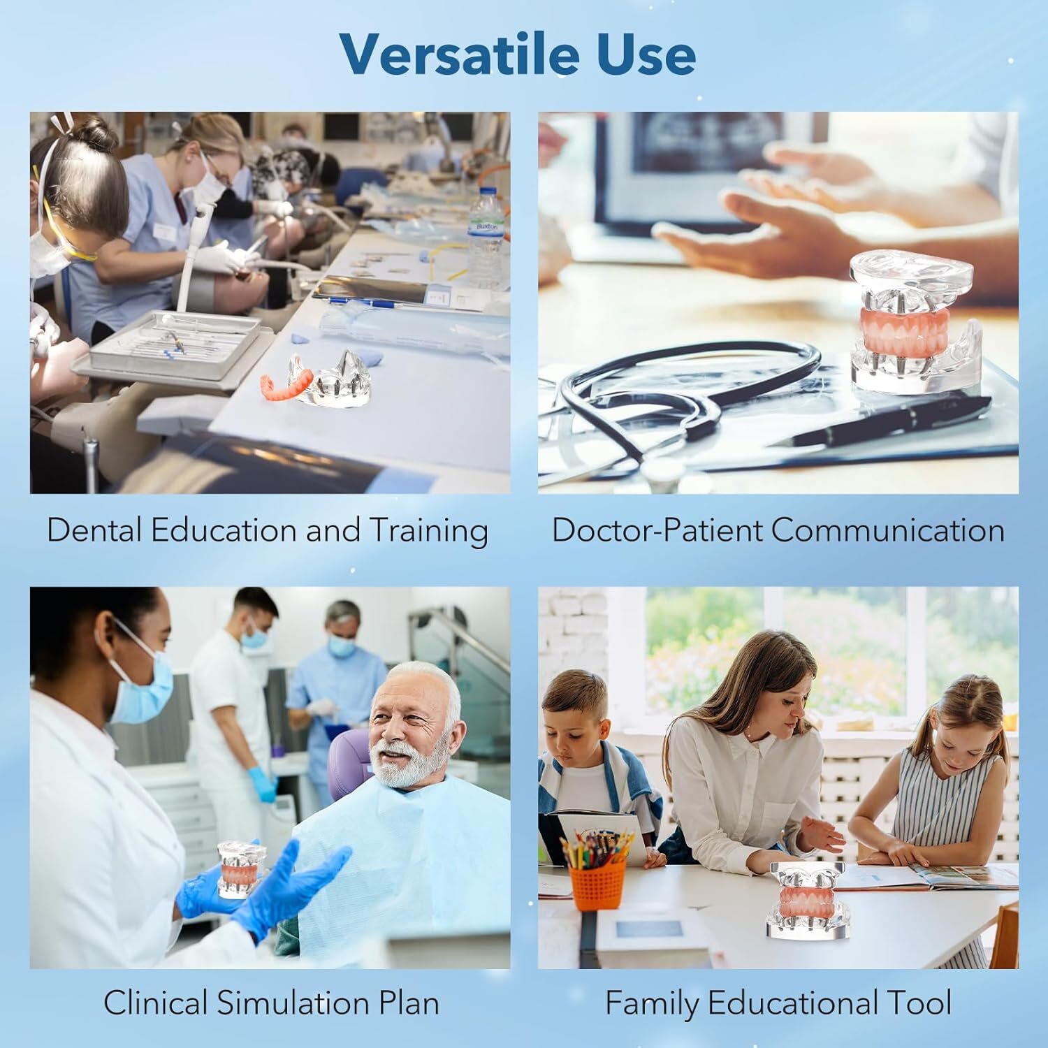 Dental Implant All-on-4 Overdenture Treatment Model Upper/Lower 4 Implants Clear