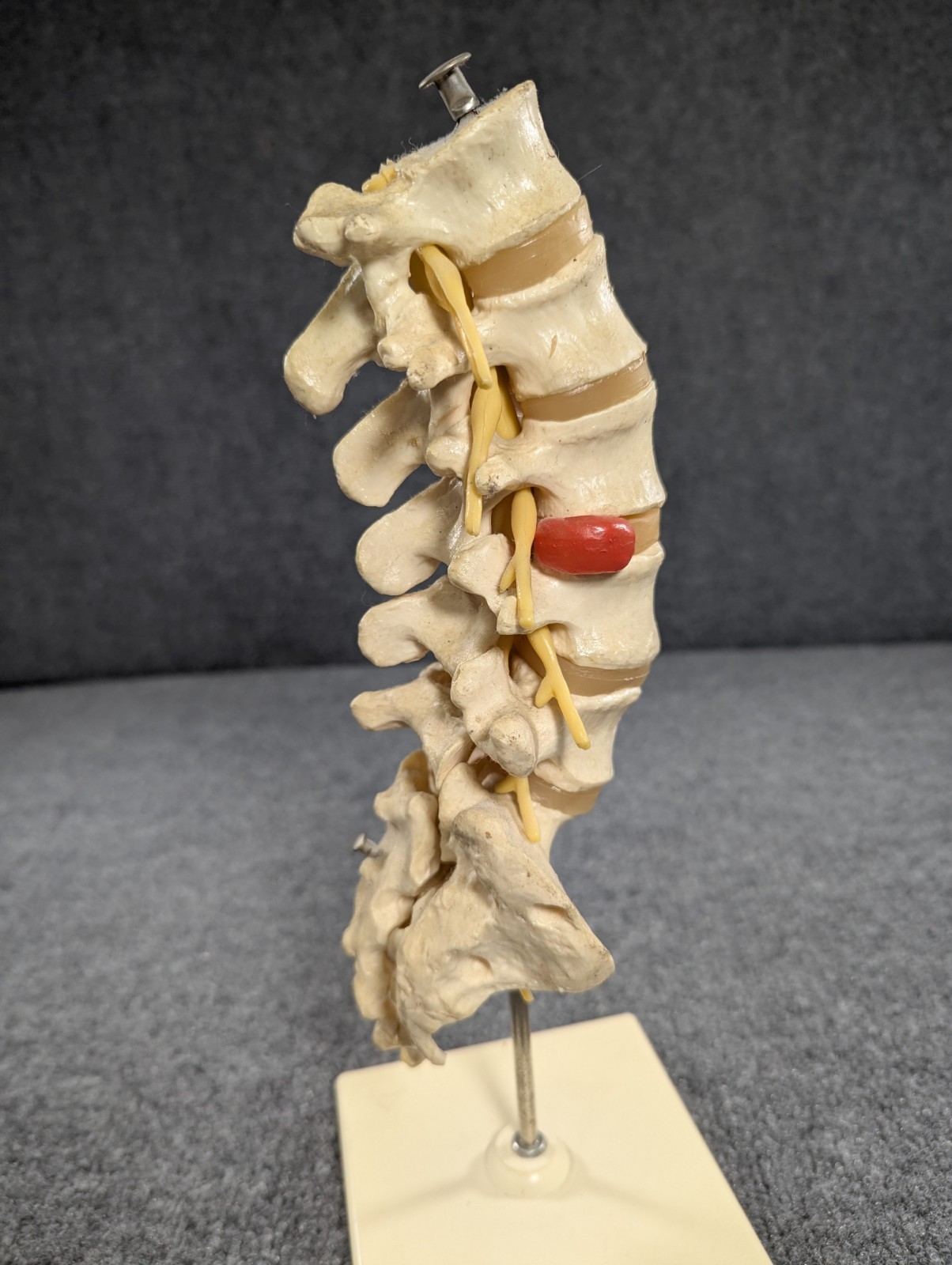Human Lumbar Spinal Column 3B Scientific Anatomical Model Anatomy West Germany