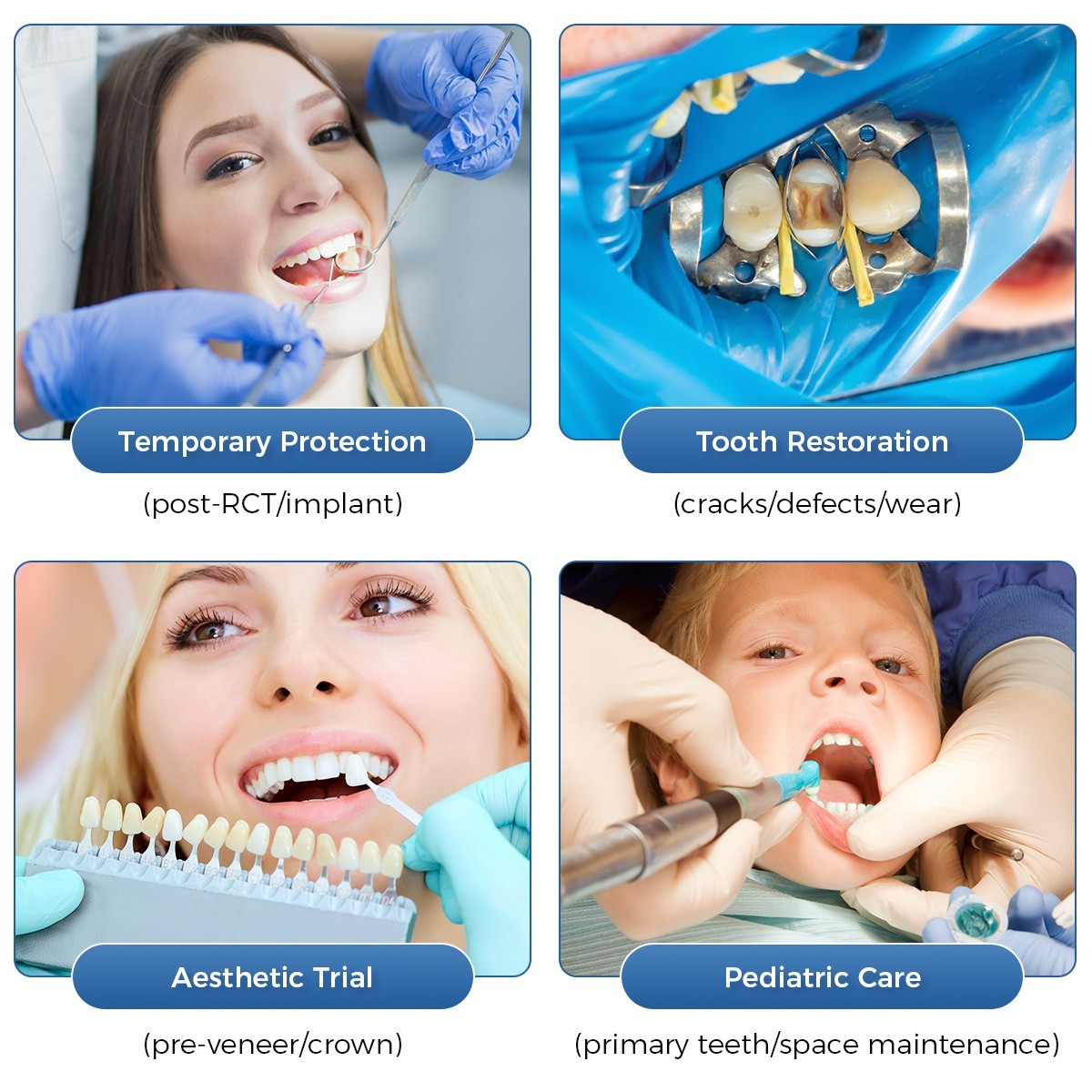 Resin Teeth Dental Temporary Crown Anterior Posterior teeth natural color