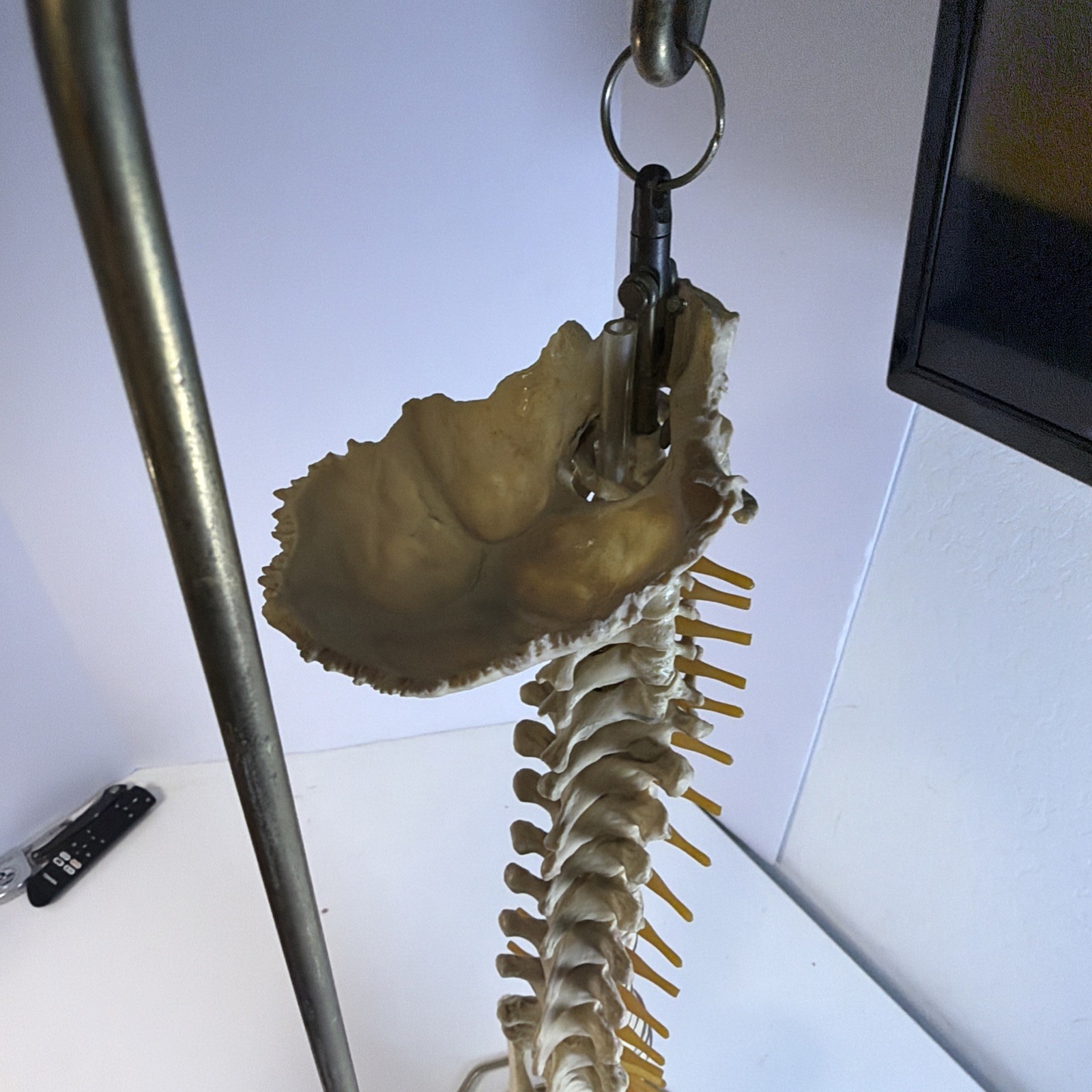 Vintage ORTHOFLEX Human Pelvis Vertebrae Skull Base Spinal Nerve Cord Spine