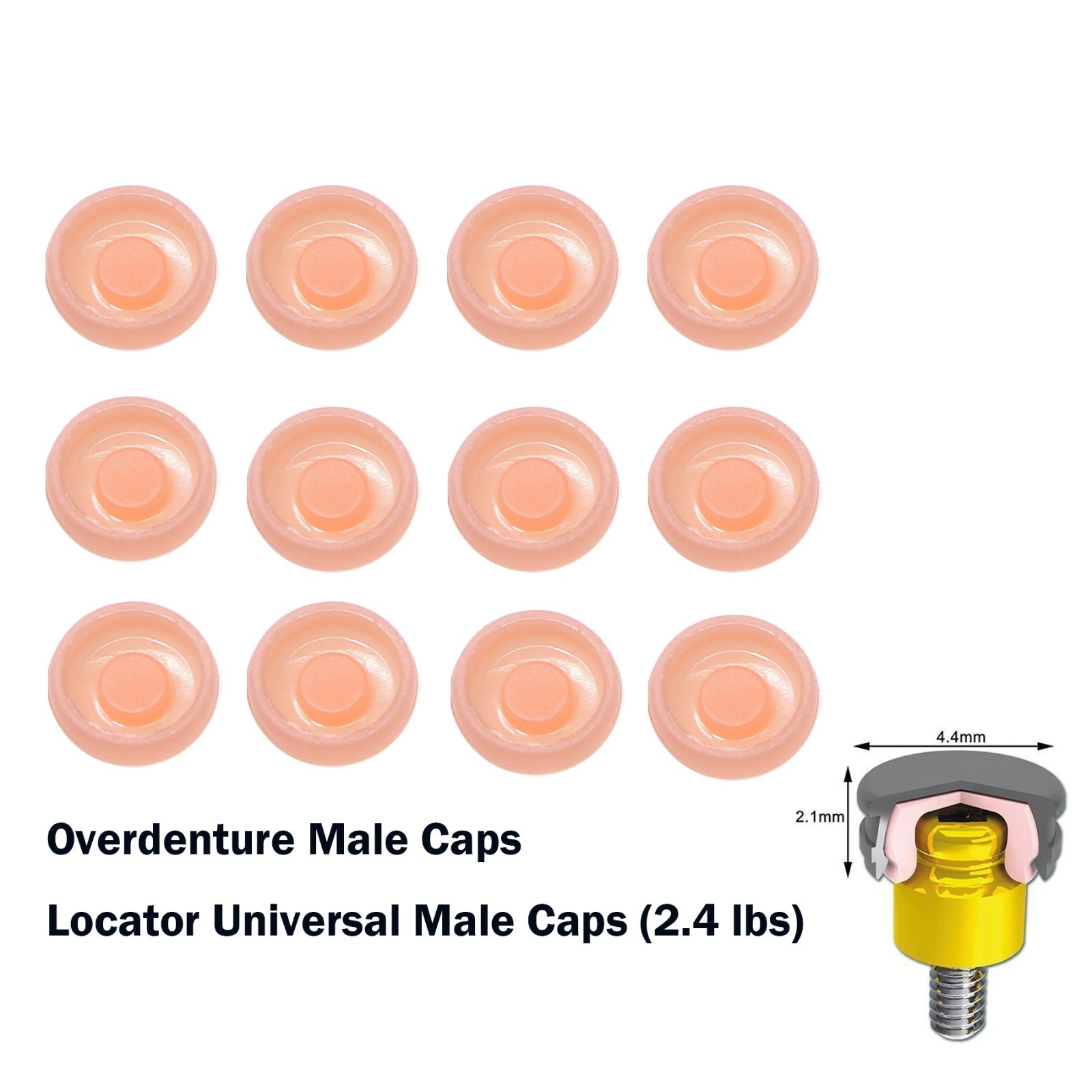 Zest Locator Abutment Retention Replacement Insert Cap Dental Overdenture Parts