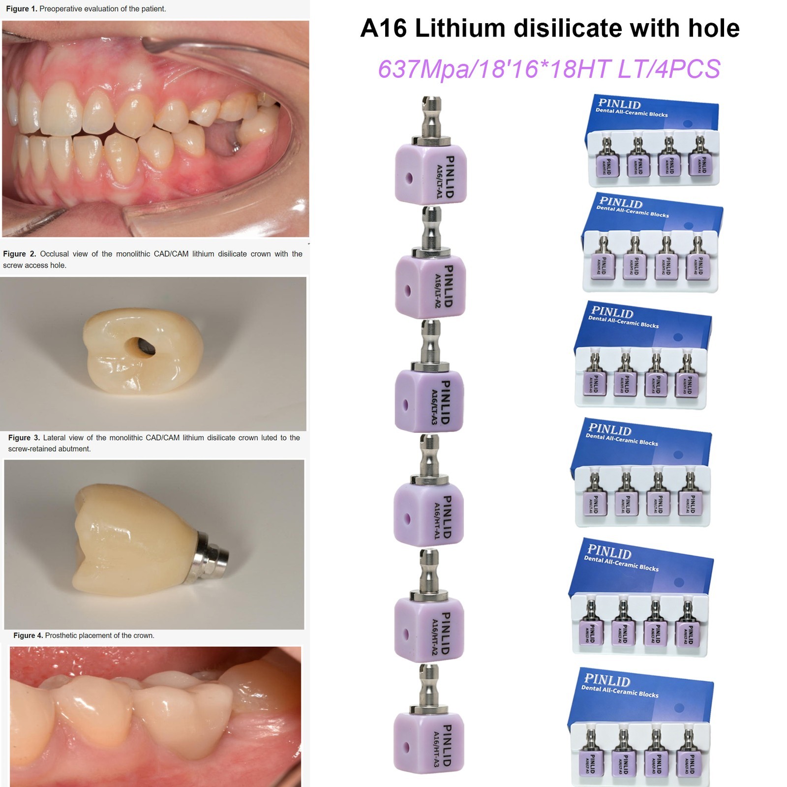 C14 B40 A16 Lithium Disilicate Glass Block for CEREC inLab Dental Restoration