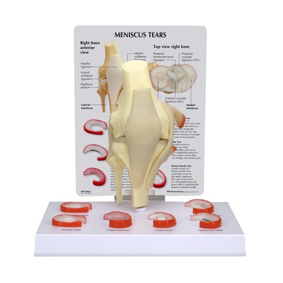 Knee Joint GPI Anatomical Model Meniscus Tears LFA#1010 Make Us An Offer! VIDEO