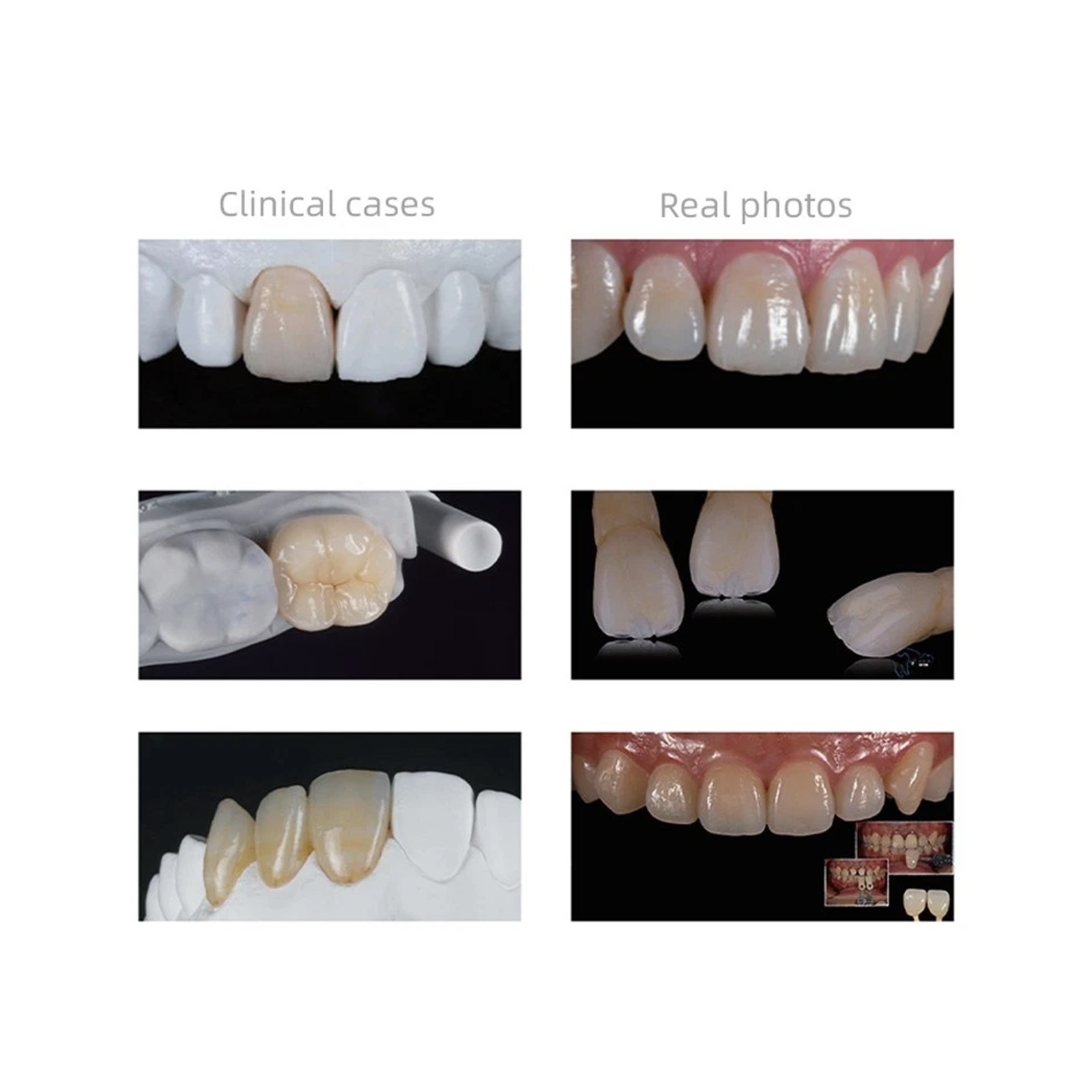 C14 Dental Emax Ceramic Blocks Lithium Disilicate CAD/CAM CEREC Block 5Pcs/box