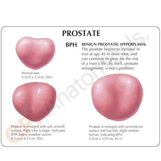 Male Pelvis GPI Anatomy Mode Prostate w Key LFA #3550 Make Us an Offer SEE VIDEO