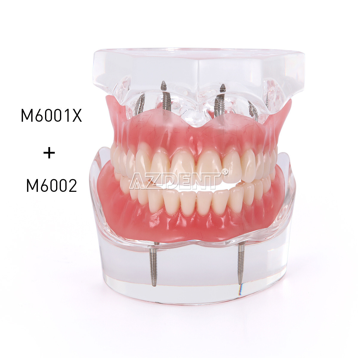 Dental Overdenture Implant Teeth Model Denture with implant Demonstration Clear