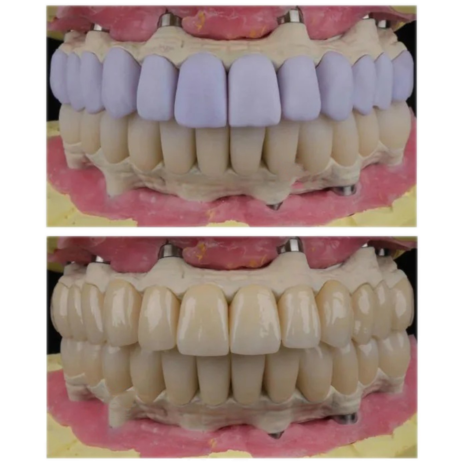 MT C14 Dental Emax CAD/CAM Glass Ceramic Blocks Lithium Disilicate CEREC Block