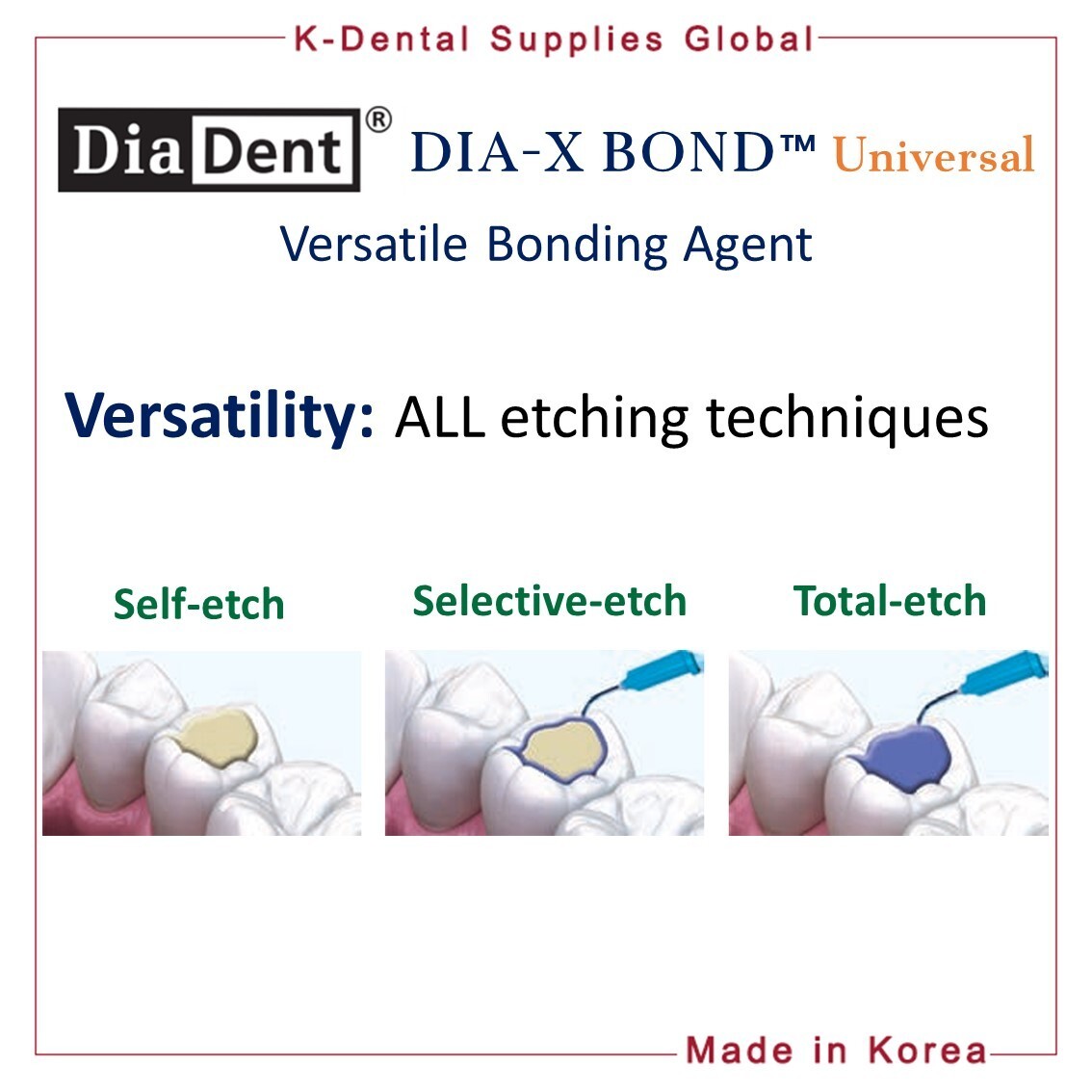 Diadent Dia-X Bond Universal Versatile Dental Bonding Agent 5ml