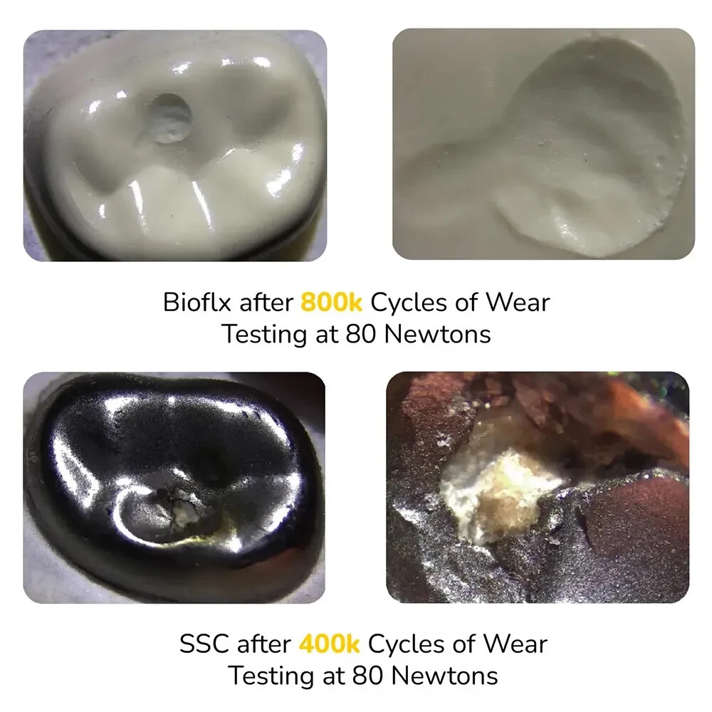 Kids-e-Dental BioFlx Lower Right 2nd Molar Crowns Refills