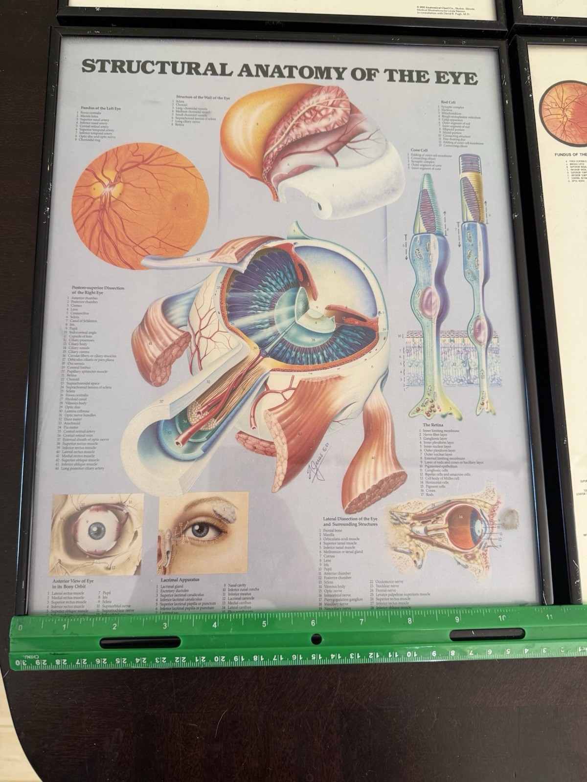 Vintage Anatomical Chart Company Framed Eye Art – 1986-92 – Set of 4 – Optometry