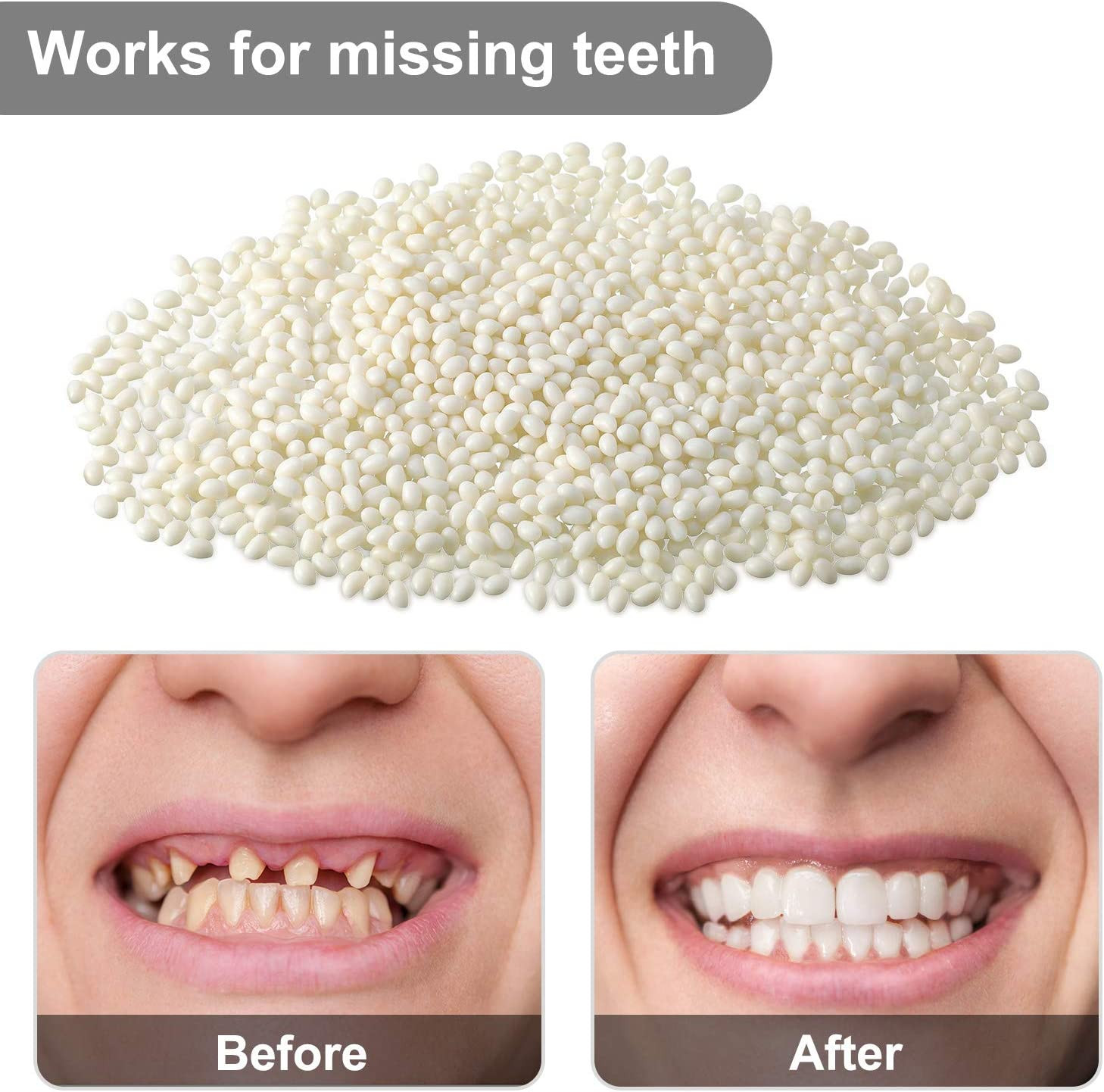 100g Moldable Thermal Teeth Whitening Gel Beads for Halloween Makeup