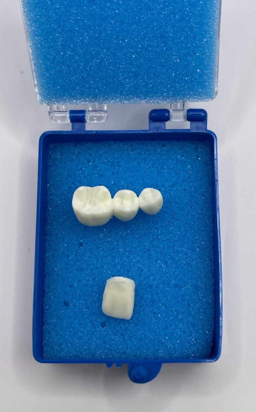 50 Pack, 2″ Blue Crown Foam Case Container Hinged Display Box Jewelry Teeth