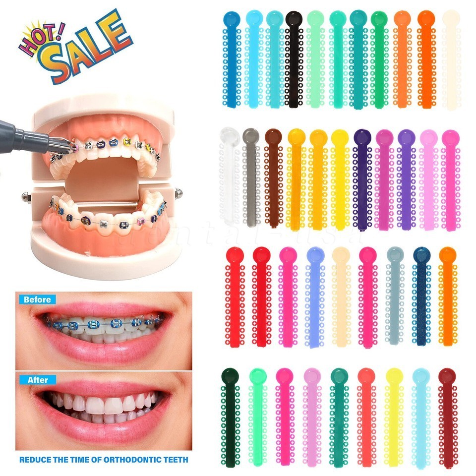 1040 Pcs Dental Orthodontic Ligature Ties Elastic Braces Rubber Bands Ligaduras