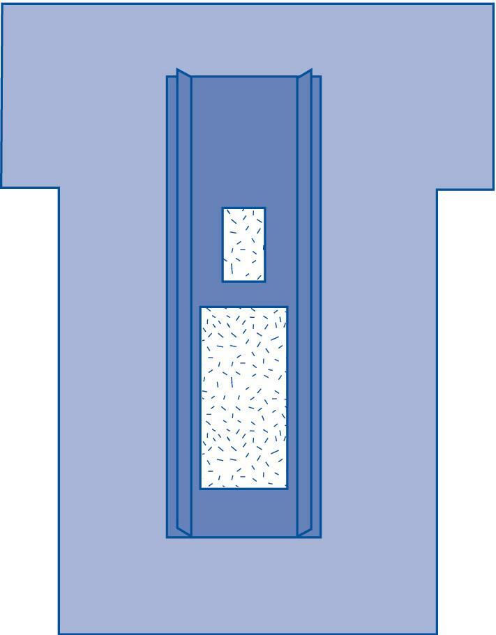 *1-Pack* Medline Cardiovascular Incise Level 4 Surgical Drape DYNJP4004