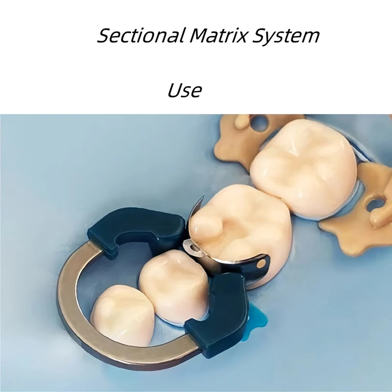 Dental Matrix Bands Ring Sectional Matrice Clamp Fit Garrison Palodent V3 System