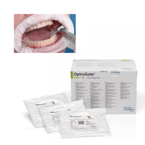 Ivoclar OPTRAGATE 3D Mouth Opener Cheek & Lip Retractor PACKS & SIZES AVAILBLE