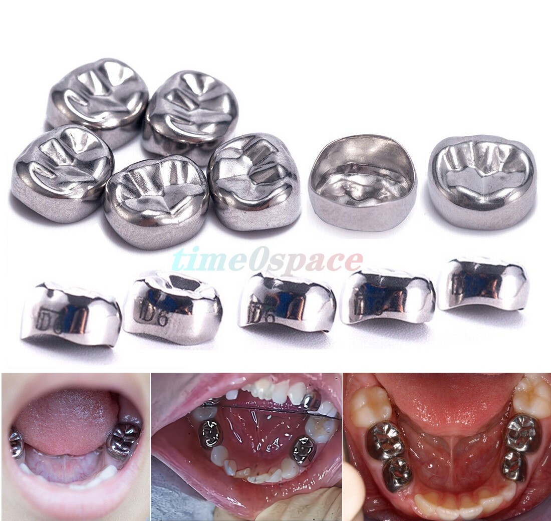 48 sizes Dental Kids Crown Primary Molar Pediatric Crowns Stainless Steel 5pcs