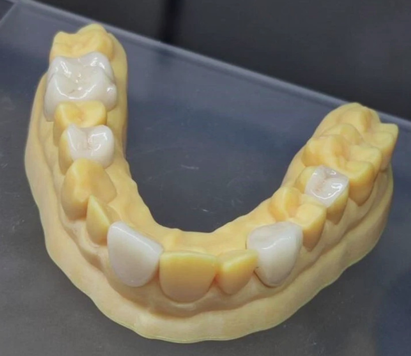 US Glass Ceramic Blocks Dental Emax CI4LT Lithium Disilicate CAD/CAM CEREC Block