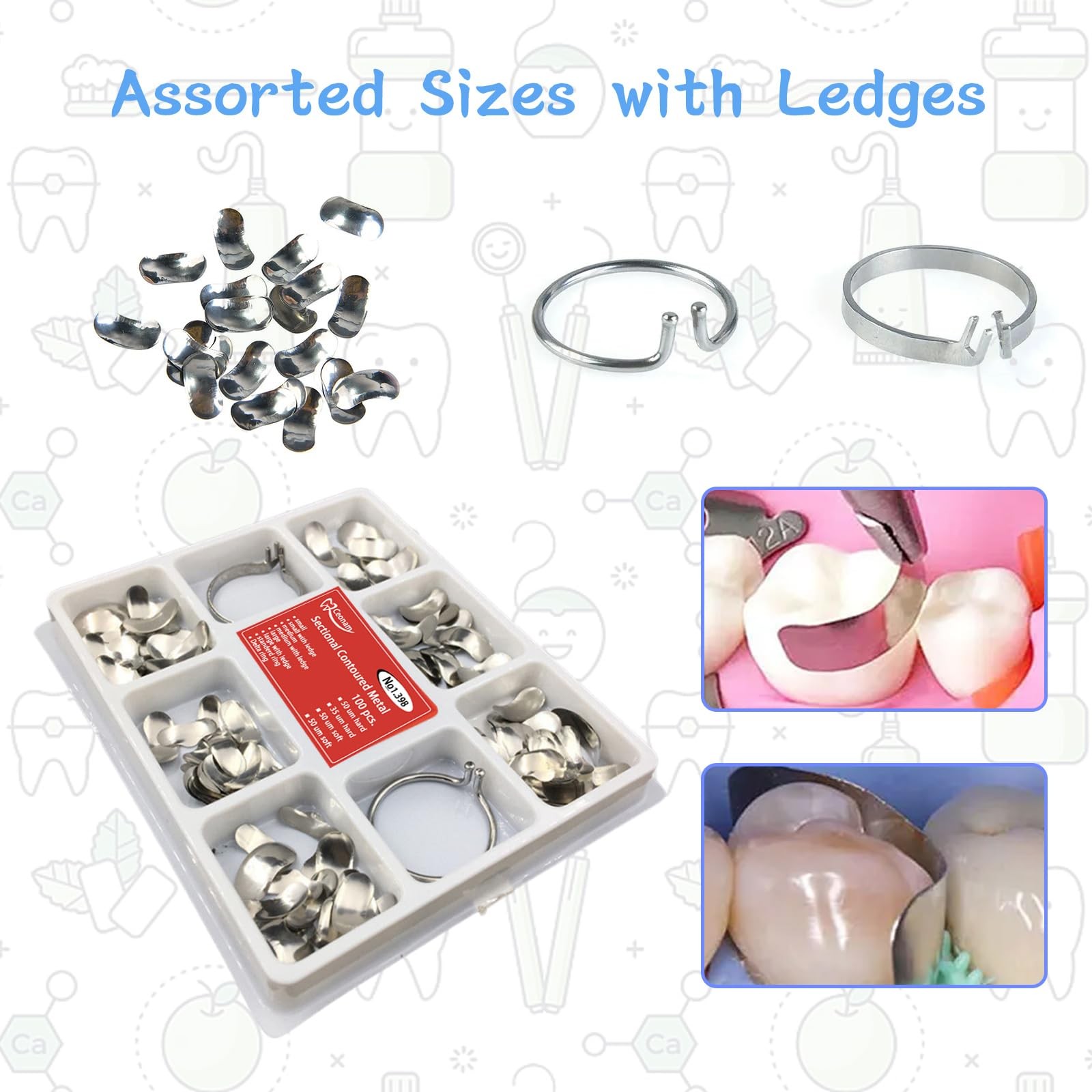 100 Pieces Stainless Steel Sectional Contoured Metal Dental Matrices Kit…