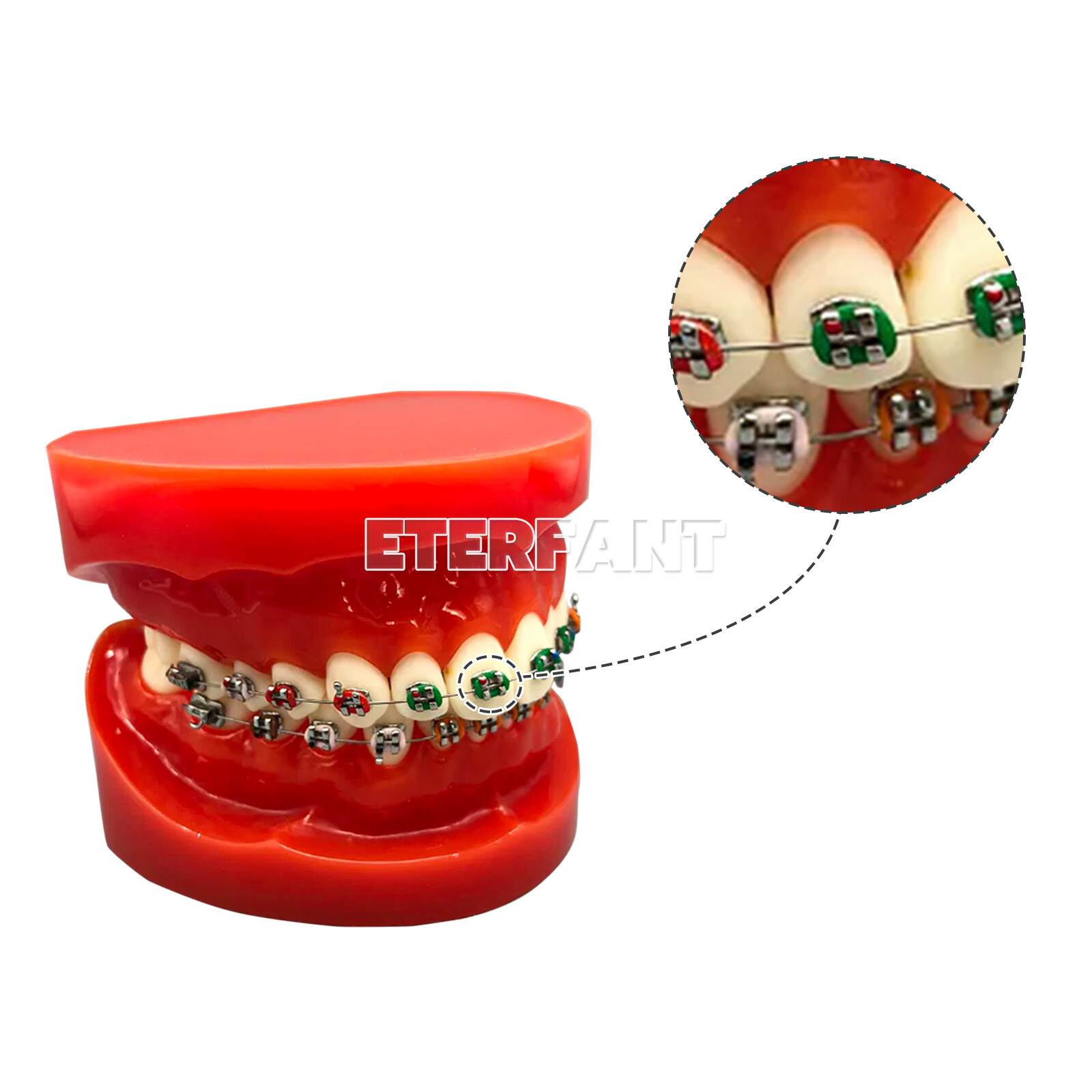 1040pc Orthodontic Ligature Ties Elastic Ligas Ortodoncia Rubber Bands Brackets