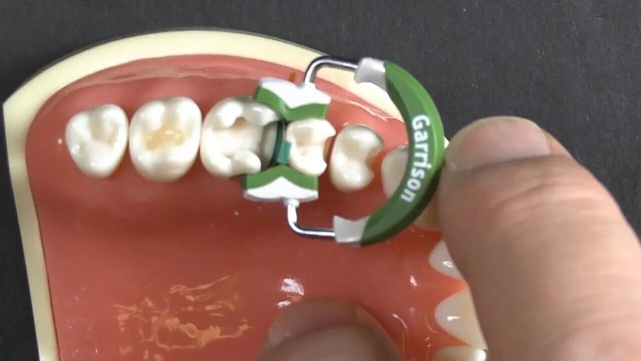 Garrison Dental Composi-Tight 3D Fusion Matrix Rings,Free Shipping