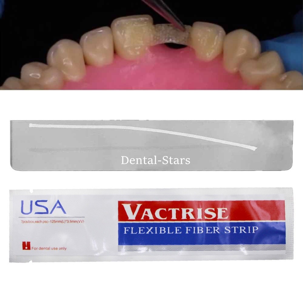 5Pcs Dental Flexible Glass Fiber Strip Splint Composite Resin Bonding Ribbon USA