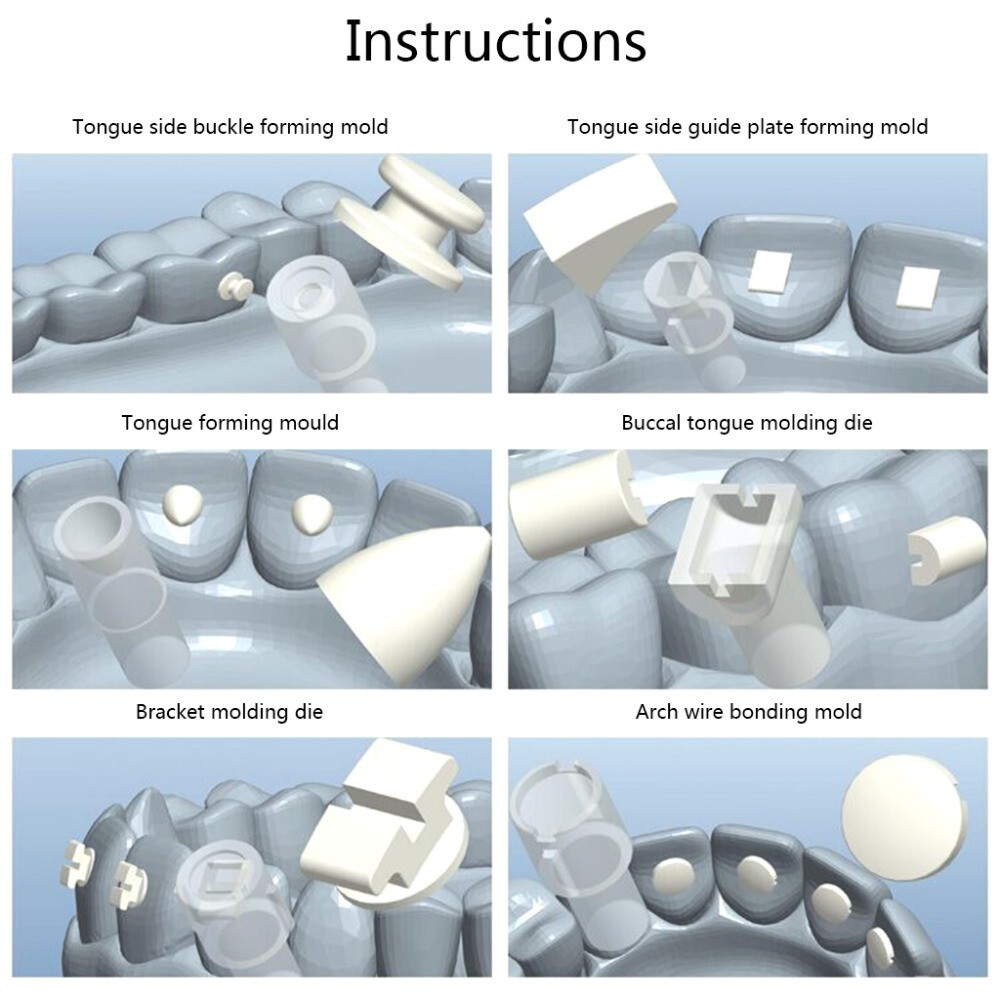1 Set Dental Orthodontic Mould Mini Accessories Ortho Injection Lingual Quick