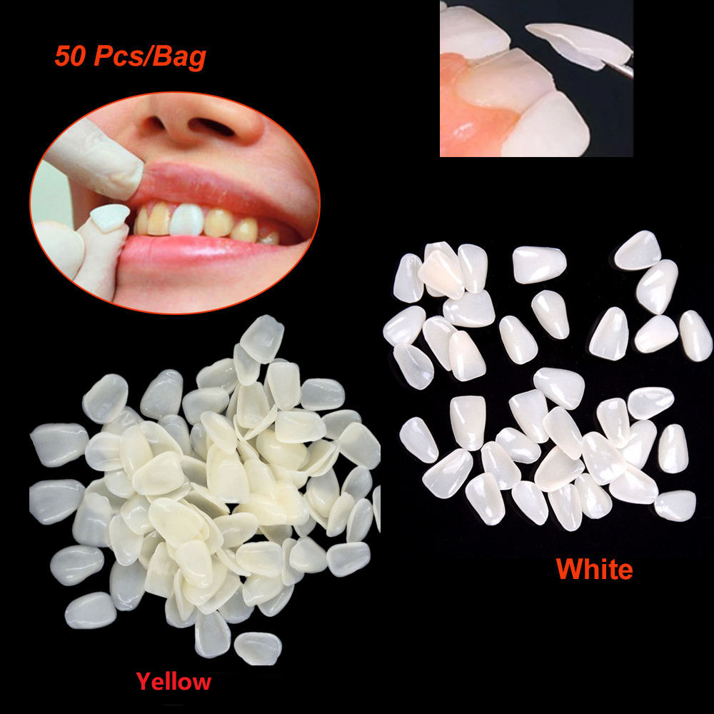 Temporary Tooth Repair Kit Tooth Cover Veneers Teeth – Piece Yellow / White US