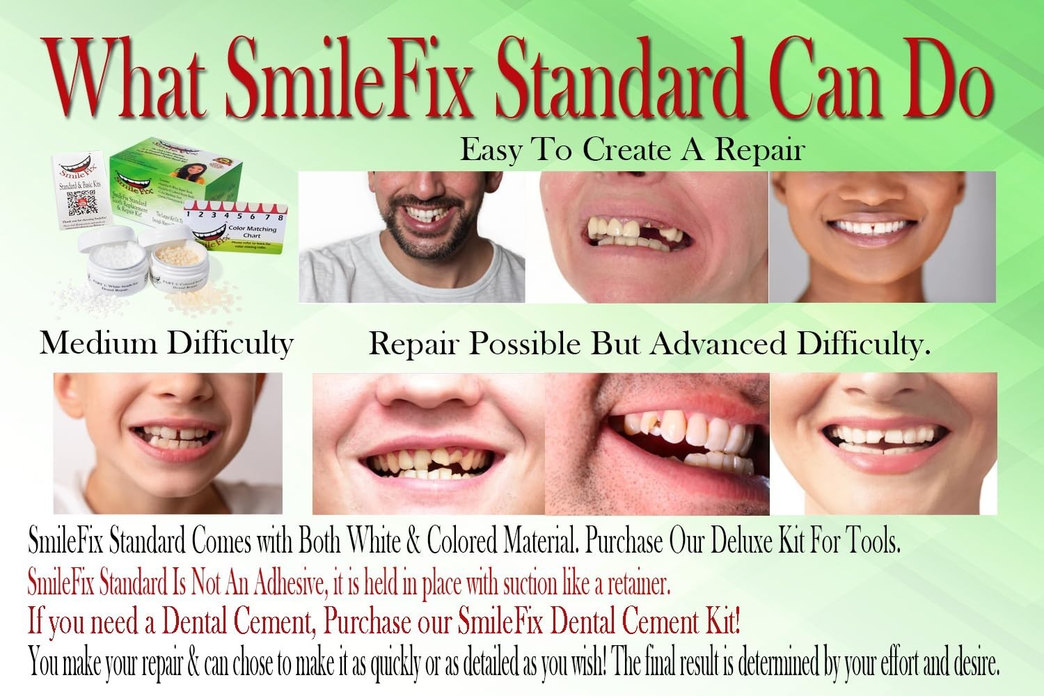 At-Home Tooth Repair Kit – Color Matching for Gaps & Broken Teeth – Easy Use