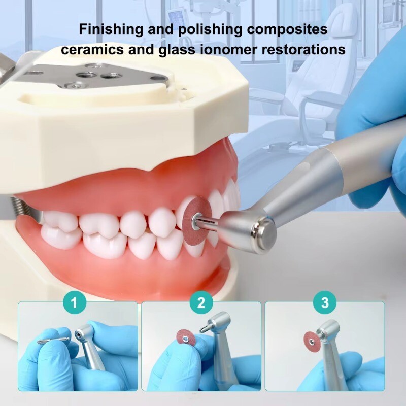 Dental Soflex Coarse Medium Superfine Fine Composite Finishing Polishing Discs