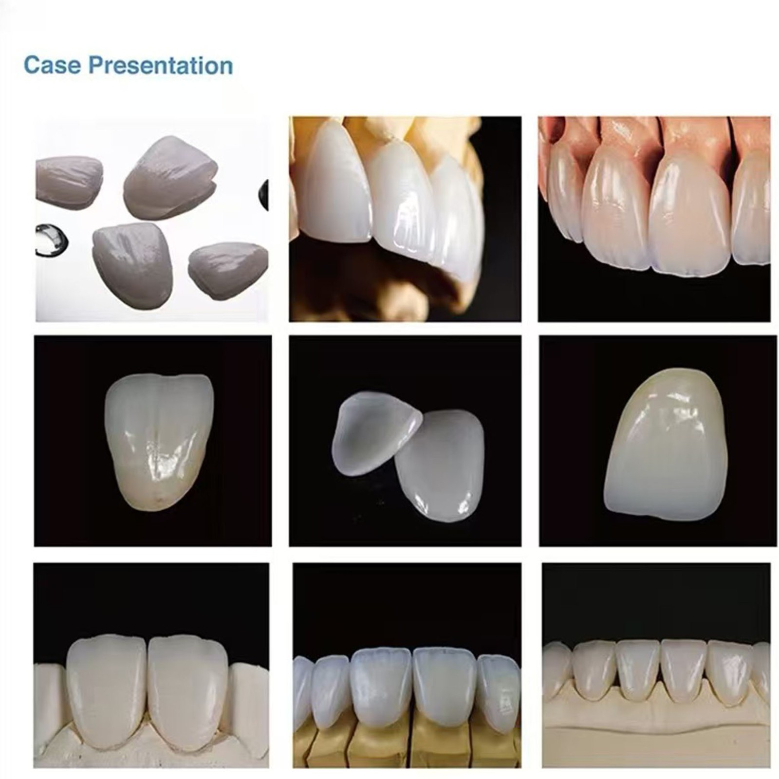US C14 Exam Ceramic Blocks Lithium Disilicate Cerec CAD CAM LT A1 A2 A3 5Pcs/Box
