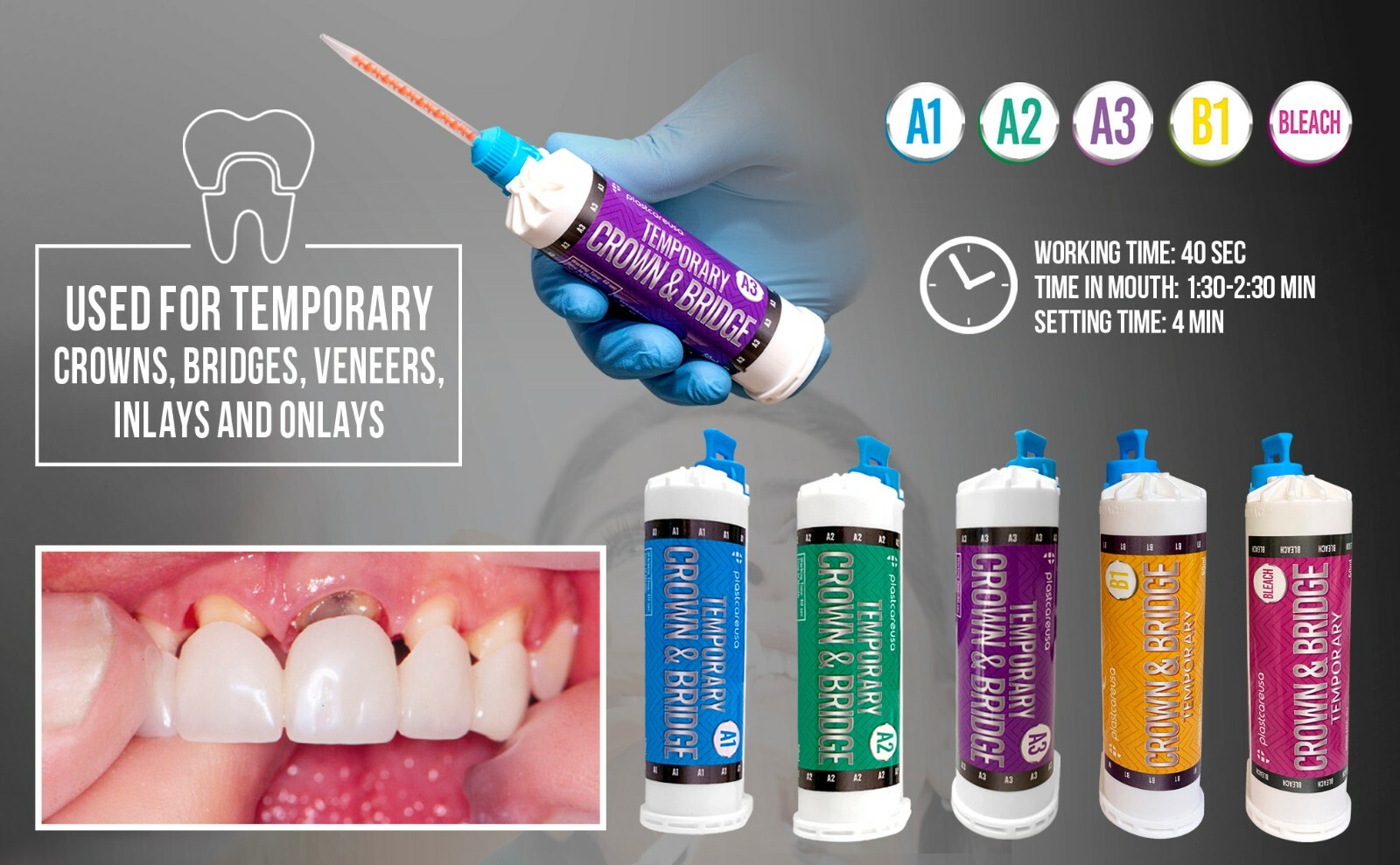 A3 Temporary Crown & Bridge Material 10:1 Dental Impression 76g (Made in GER)