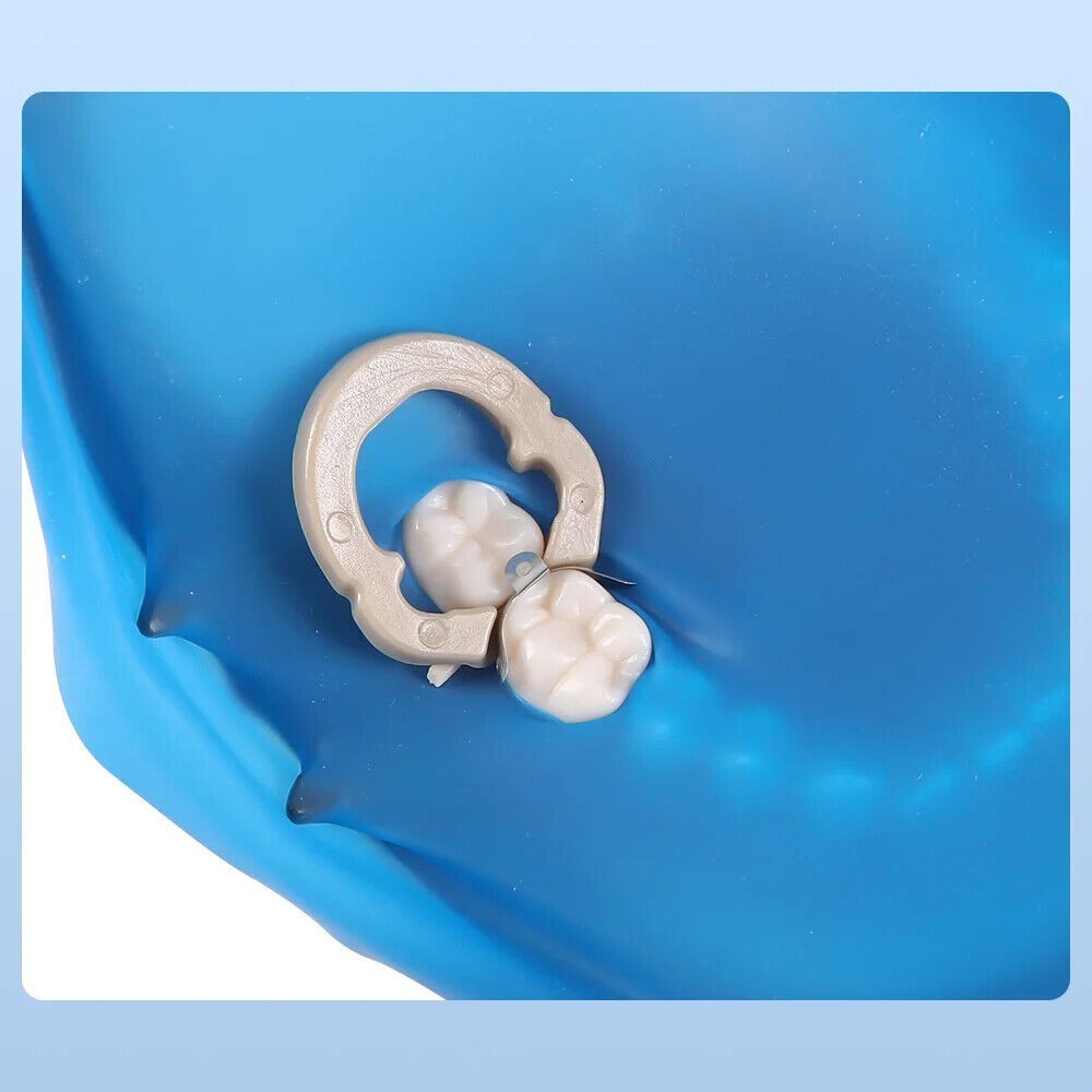 Dental M4 Matrix Bands Ring Sectional Matrice Clamp Fit Garrison Palodent V3