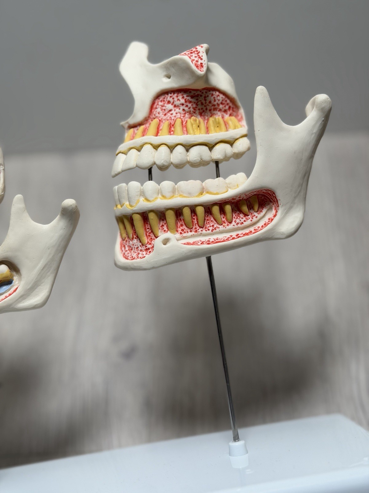 3B Scientific Dentition Development Model – 4 Stages Dental Teeth education