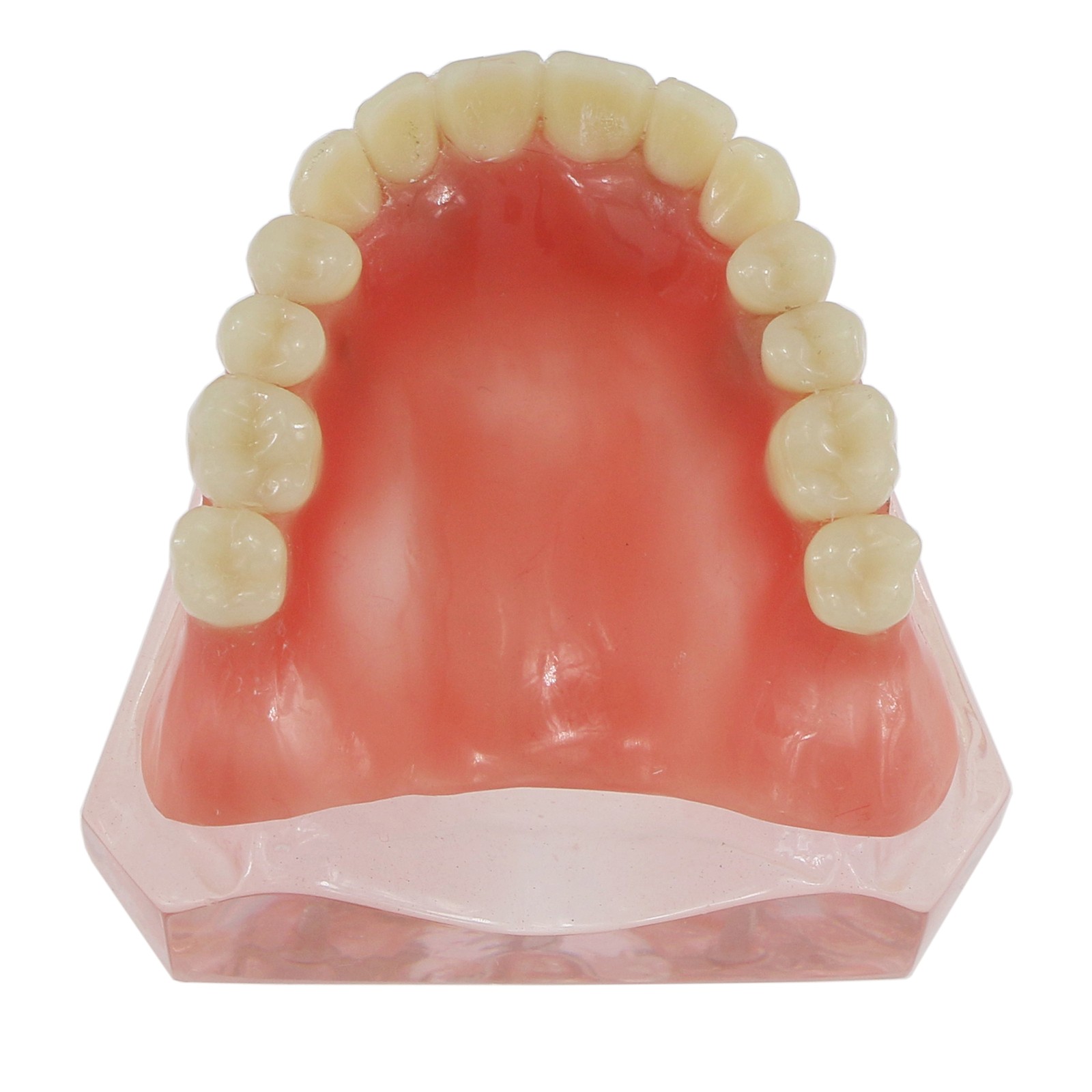 Dental Teeth Model Upper Lower Tooth 4 Implants Restoration Overdenture Model