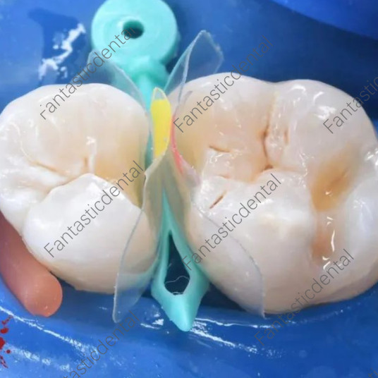 Dental Transparent Matrix Clear Bow Matrice Band Anterior Front Bioclear TorVM
